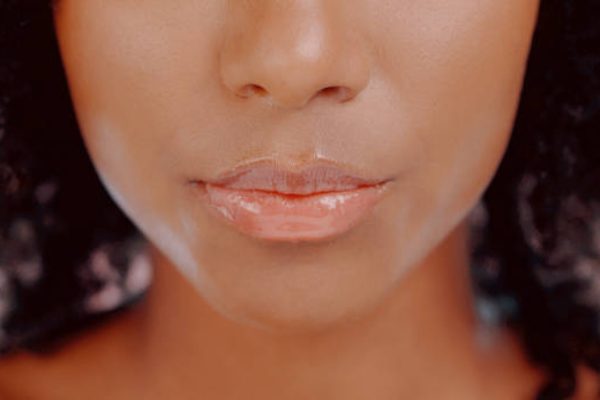 How to Lighten Dark Lips: Natural Home Remedies