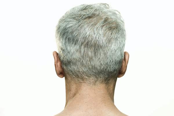 Gray Hair: Causes, How to Disguise, Avoid and More